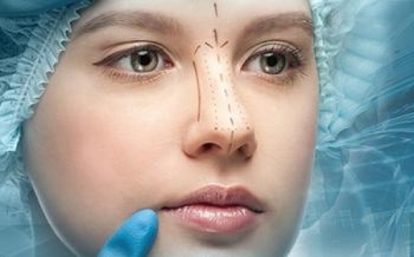 After Nose Operation